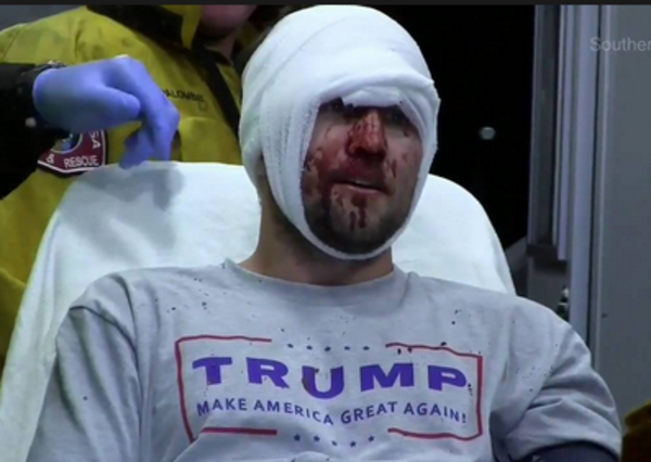 Mainstream Media Has Ignored Over 538 Violent Attacks on Trump Supporters