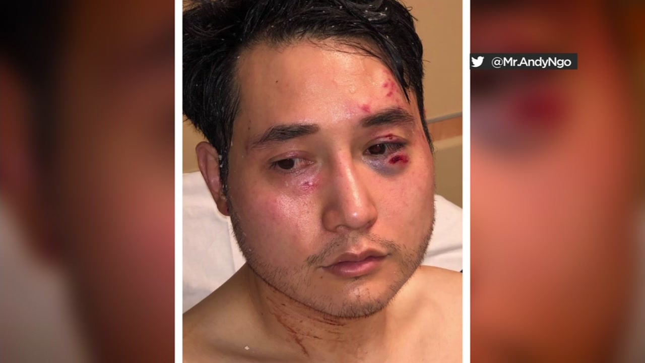 Portland journalist Andy Ngo speaks out, says Antifa behind attack (Video Added!)