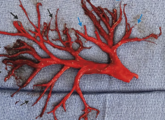 Died Suddenly – a Cathartic Review, by Ricky Daytona